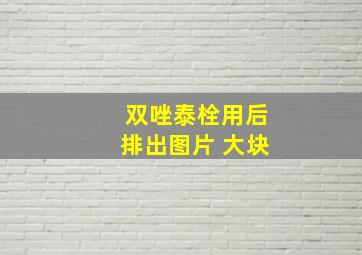 双唑泰栓用后排出图片 大块